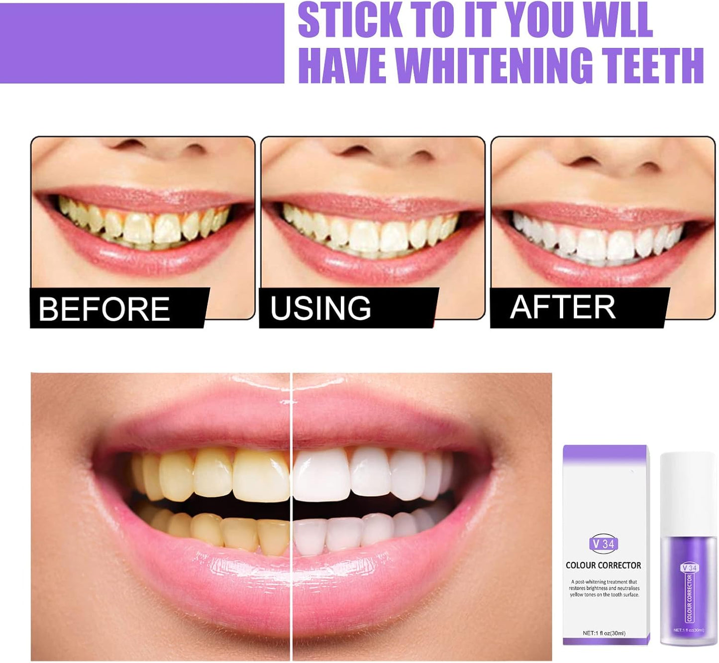 Hismile Teeth Whitening